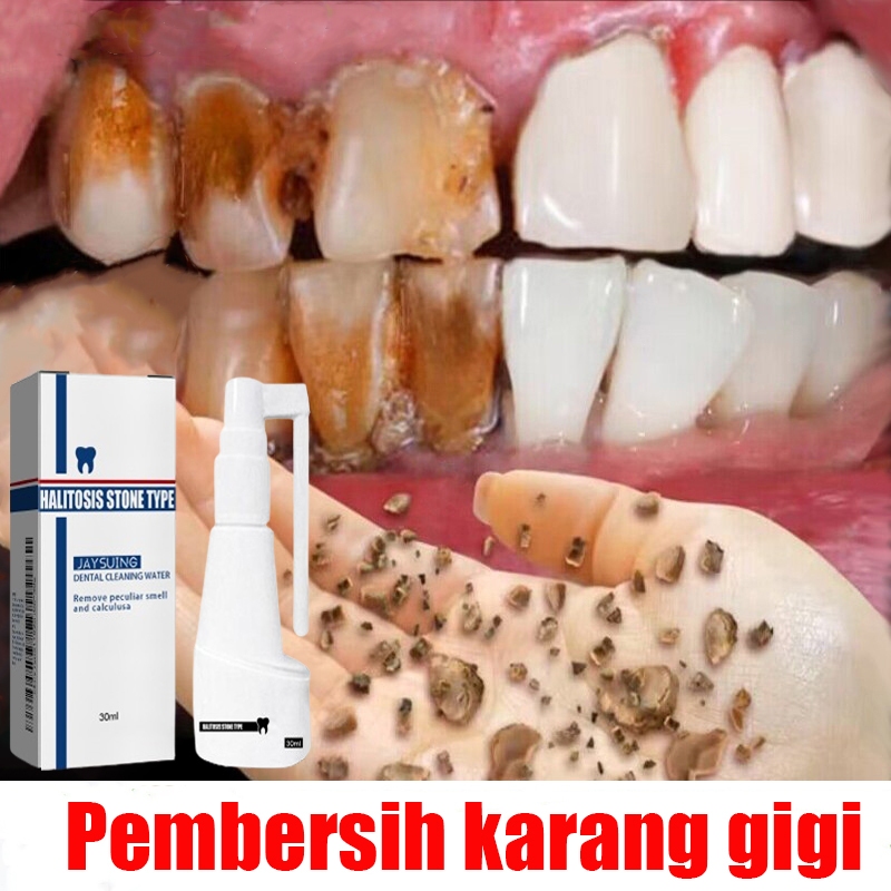 Pembersih karang gigi Perontok karang gigi Odol pemutih gigi dan karang gigi 30ml Pasta gigi pemutih