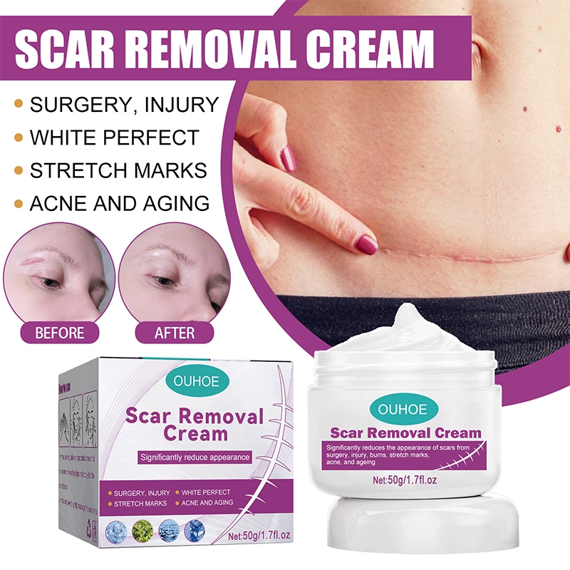 [COD]Scar Remover Cream 50g Koreng Advanced Scar Gel Dermatik Obat Bekas Luka Luka Jahitan Bekas Luk