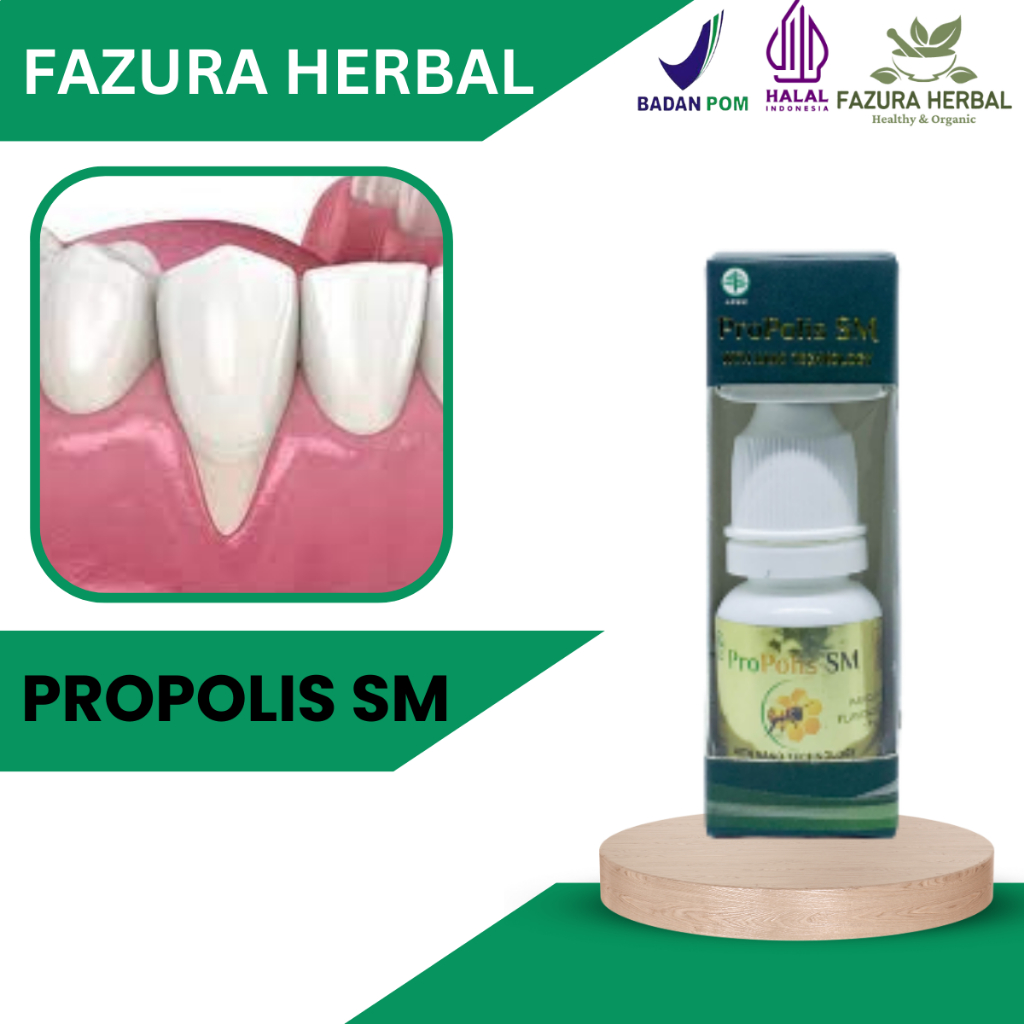 Propolis SM - Obat Gusi Turun, Obat Gusi Merosot, Obat Gusi Jatuh, Obat Resesi Gingiva, Obat Periodo