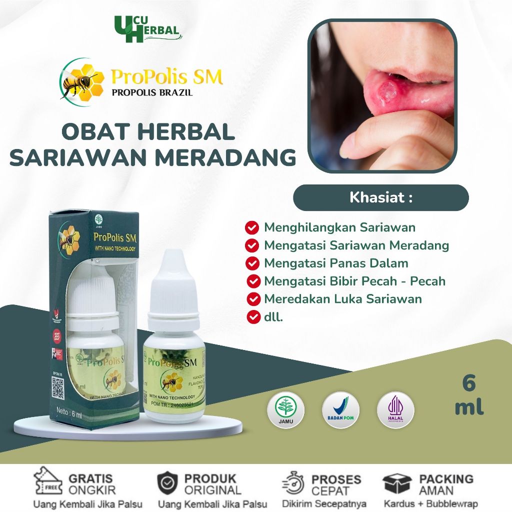 Obat Tetes Sariawan, Obat Sariawan di Bibir, Obat Panas Dalam Sariawan, Obat Penghilang Luka Sariawa