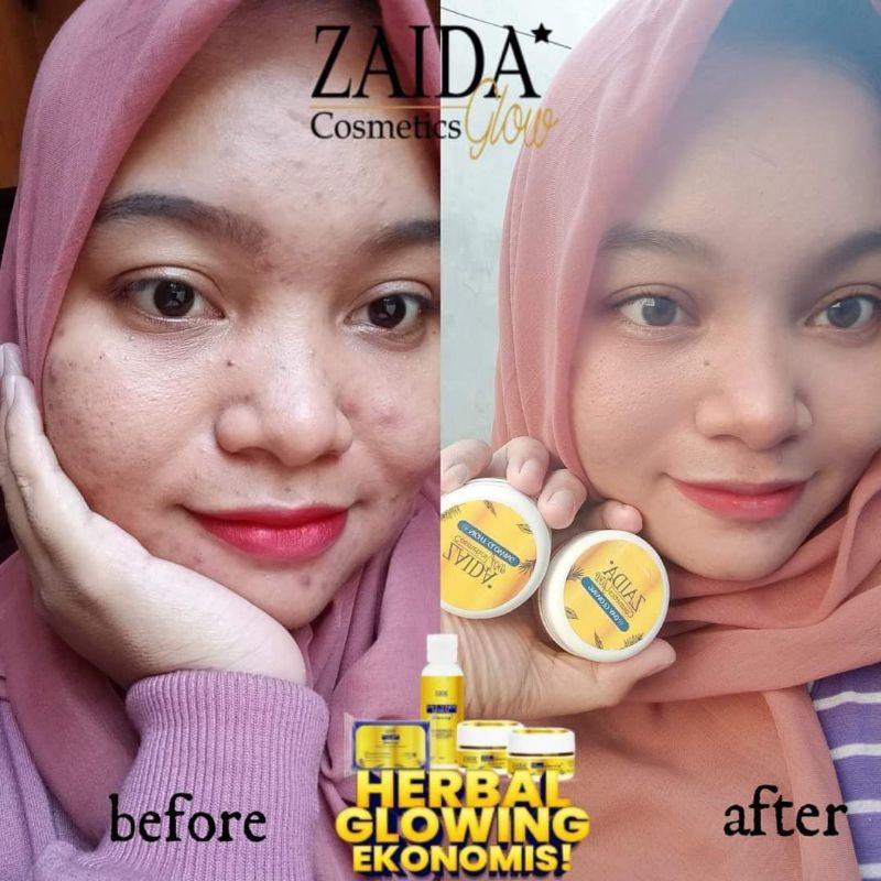 herbal glowing zaida glow