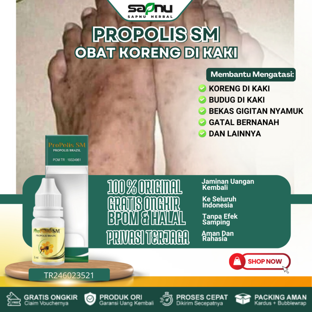 Obat Koreng Di Kaki Salep Korengan Koreng Gatal Luka Robek Luka Borok Penghilang Bekas Luka Luka Bak