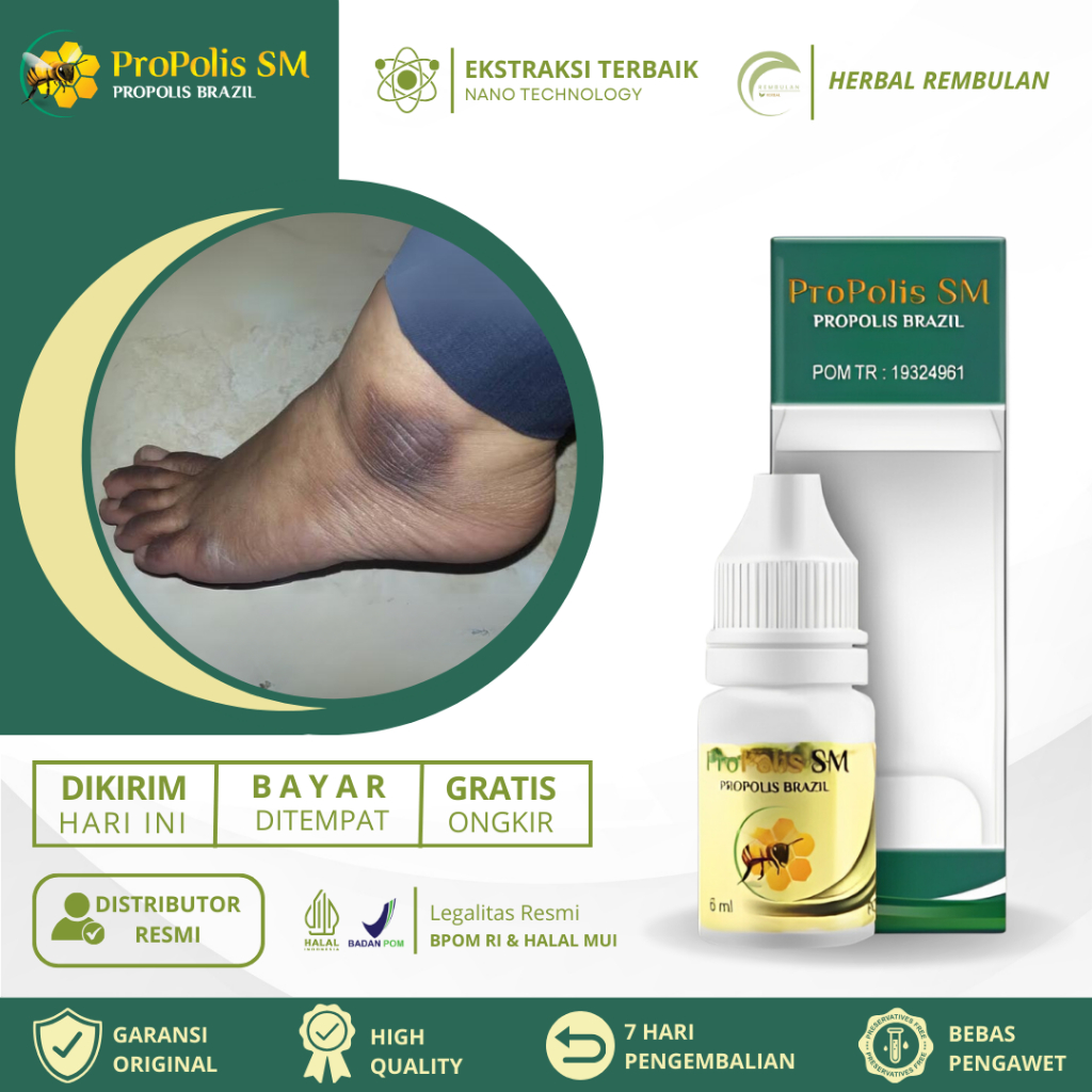 Obat Mata Kaki Hitam, Salep ata Kaki Hitam, Obat Kaki Kapalan, Obat Mata Kaki Hitam & Kasar, Obat Ma