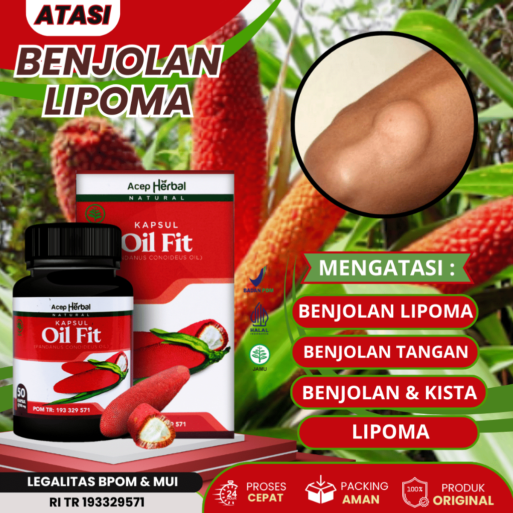 Kapsul Oil Fit - Obat Benjolan Lipoma, Benjolan Di Tangan, Benjolan Di Ketiak, Di Leher, Kelenjar Ge