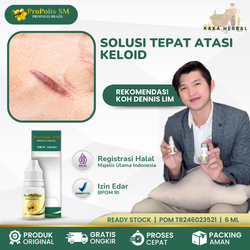 Kaka Herbal - Obat Keloid, Penghilang Keloid, Obat Oles Penghilang Keloid, Obat Bekas Luka, Obat Kel