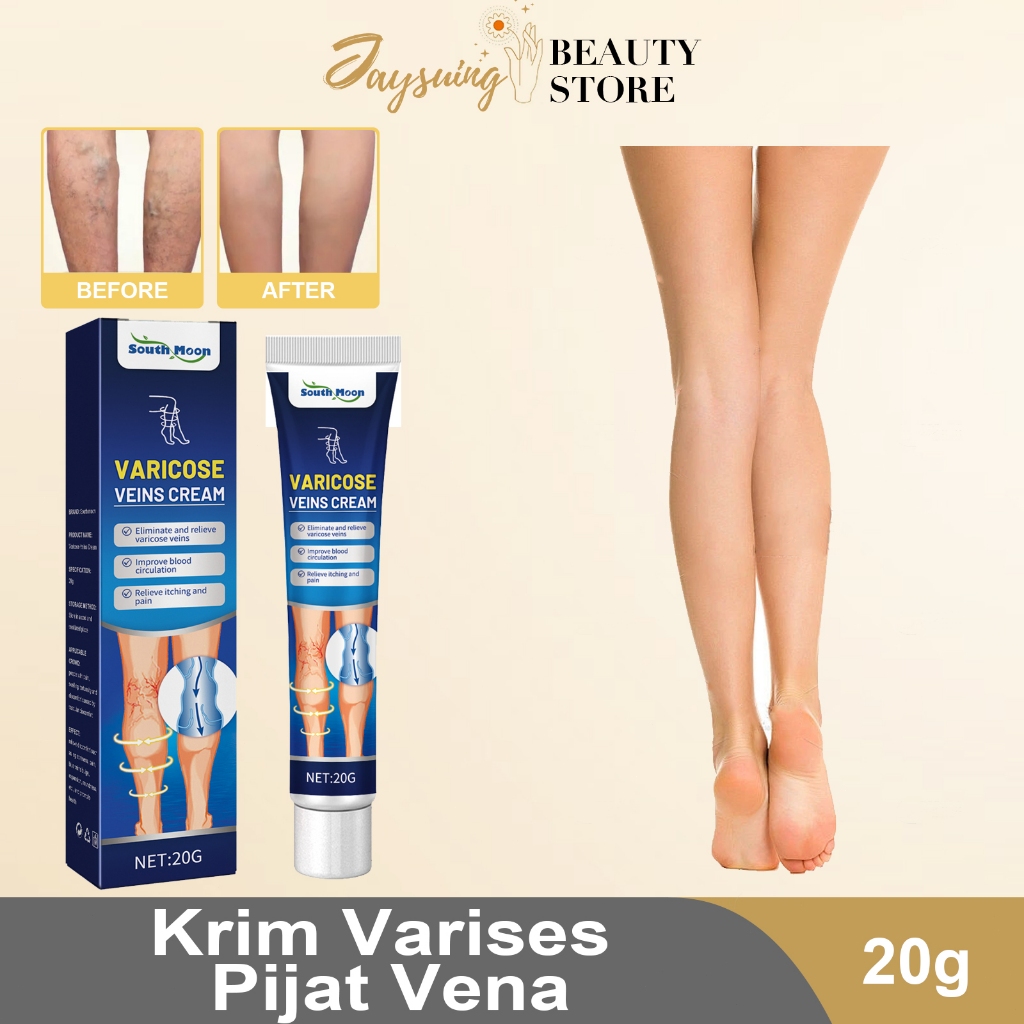 Valesin obat varises original obat parises kaki paling ampuh salep varises 20g salep laba-laba Pengo