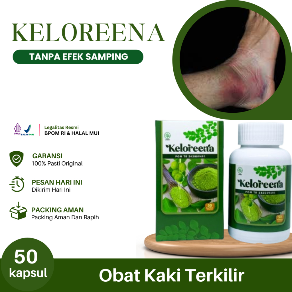 Obat Kaki Terkilir, Kaki Keseleo, Kaki Memar, Cedera Kaki, Misalah, Penyembuhan Kaki Keseleo, Kesele