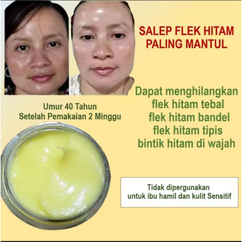 salep penghilang flek hitam tebal dan bandel