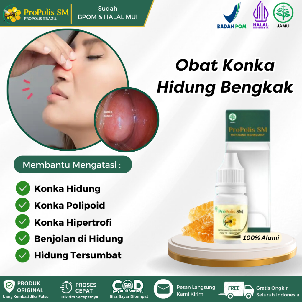 Propolis SM 6ml - Obat Konka Hidung Bengkak, Benjolan Di Rongga Hidung, Konka Hidung Membesar, Konka