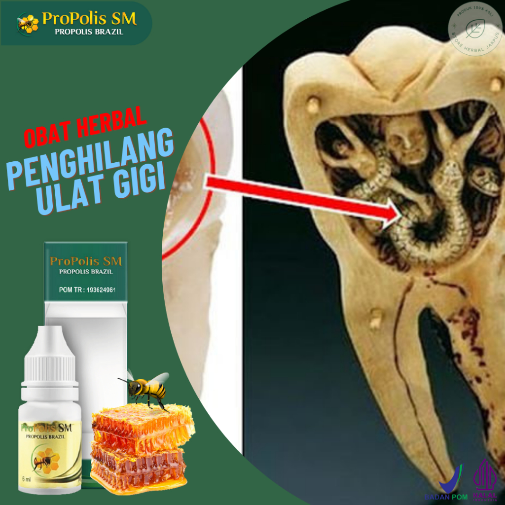 Obat Mengeluarkan Ulat Gigi - Obat Kumur Penghilang Ulat Gigi - Obat Gigi Busuk - Obat Pembunuh Ulat