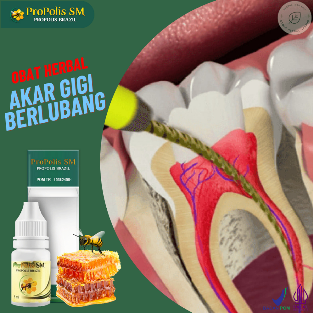 Obat Perontok Akar Gigi Ulat Gigi Berlubang Penghilang Daging Jadi Gusi Tumbuh Gigi Goyang Copot