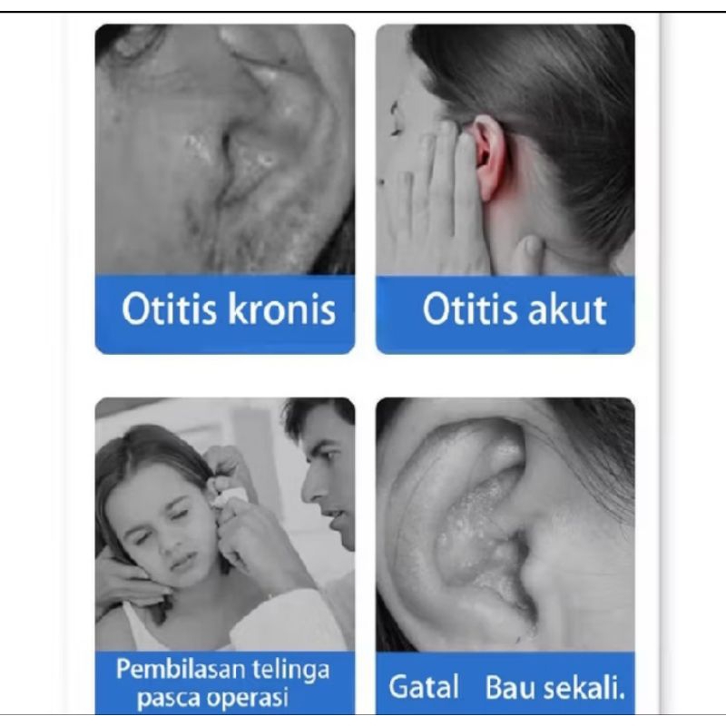 Telinga berdarah,obat telinga tuli permanen