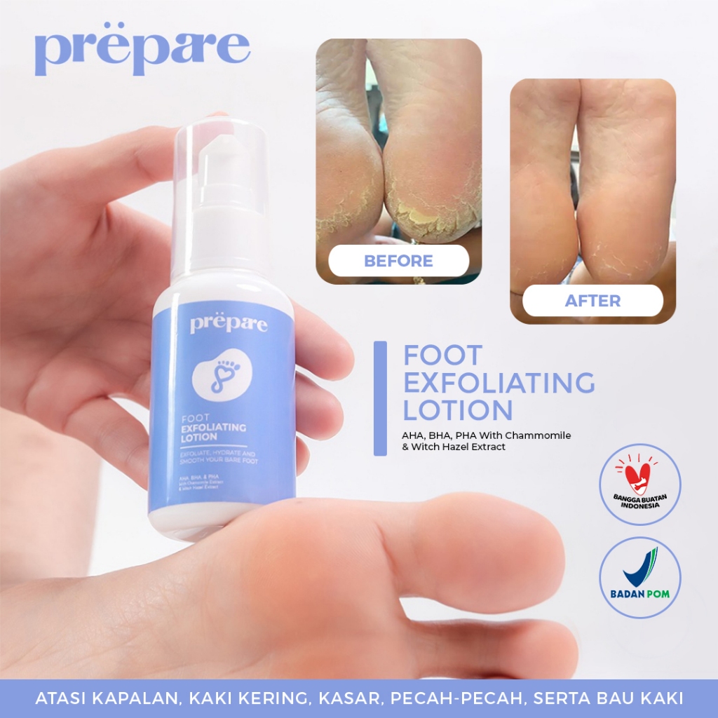 PREPARE Obat Kapalan Cream Kaki Pecah dan Kering Penghalus Tumit Kaki Penghilang Bau Kaki Jamur Kaki