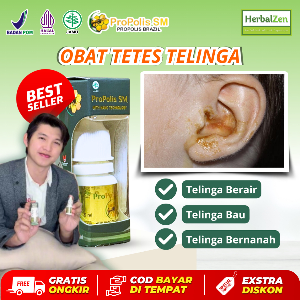 Obat Tetes Telinga Berair Dan Bau Telinga Bernanah Propolis SM