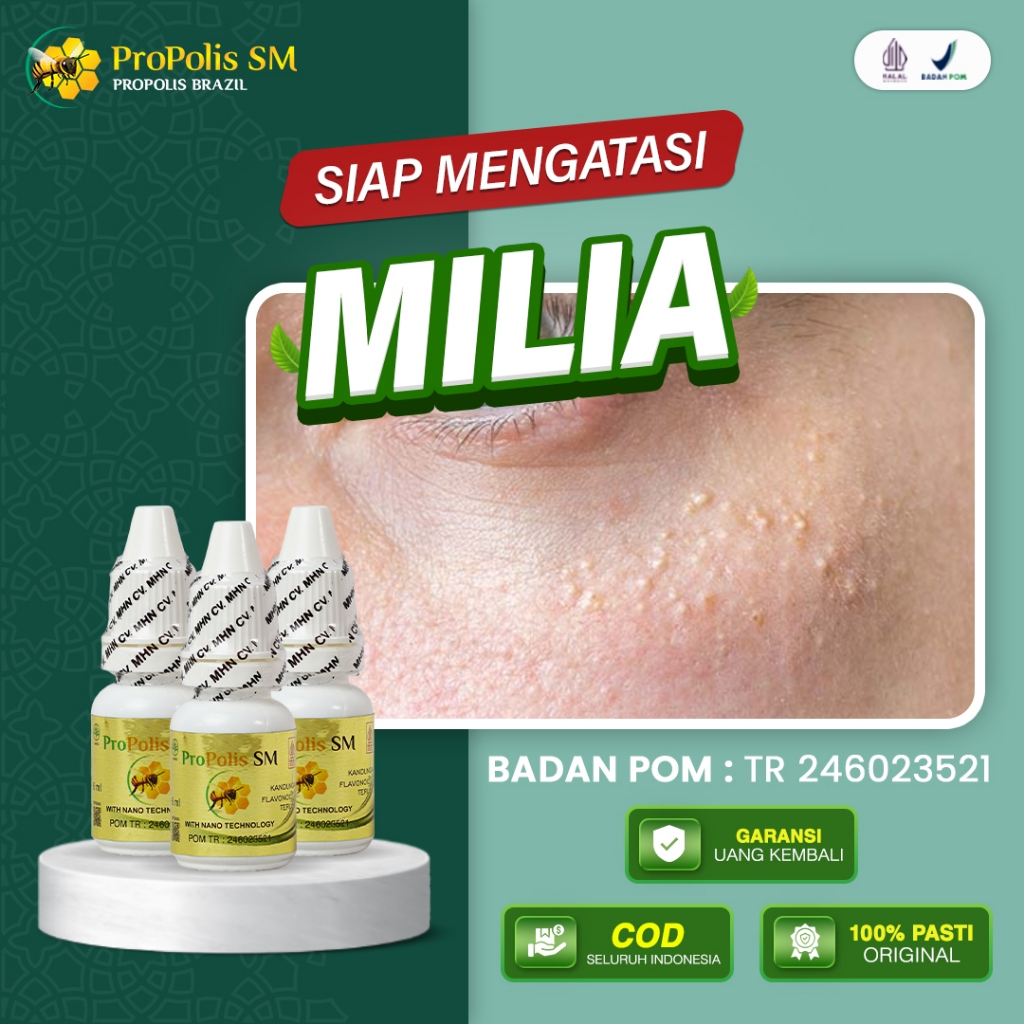 Obat Herbal Penghilang Milia Bruntusan Milia Di Bawah Mata Milia Pada Wajah Syringoma Propolis SM
