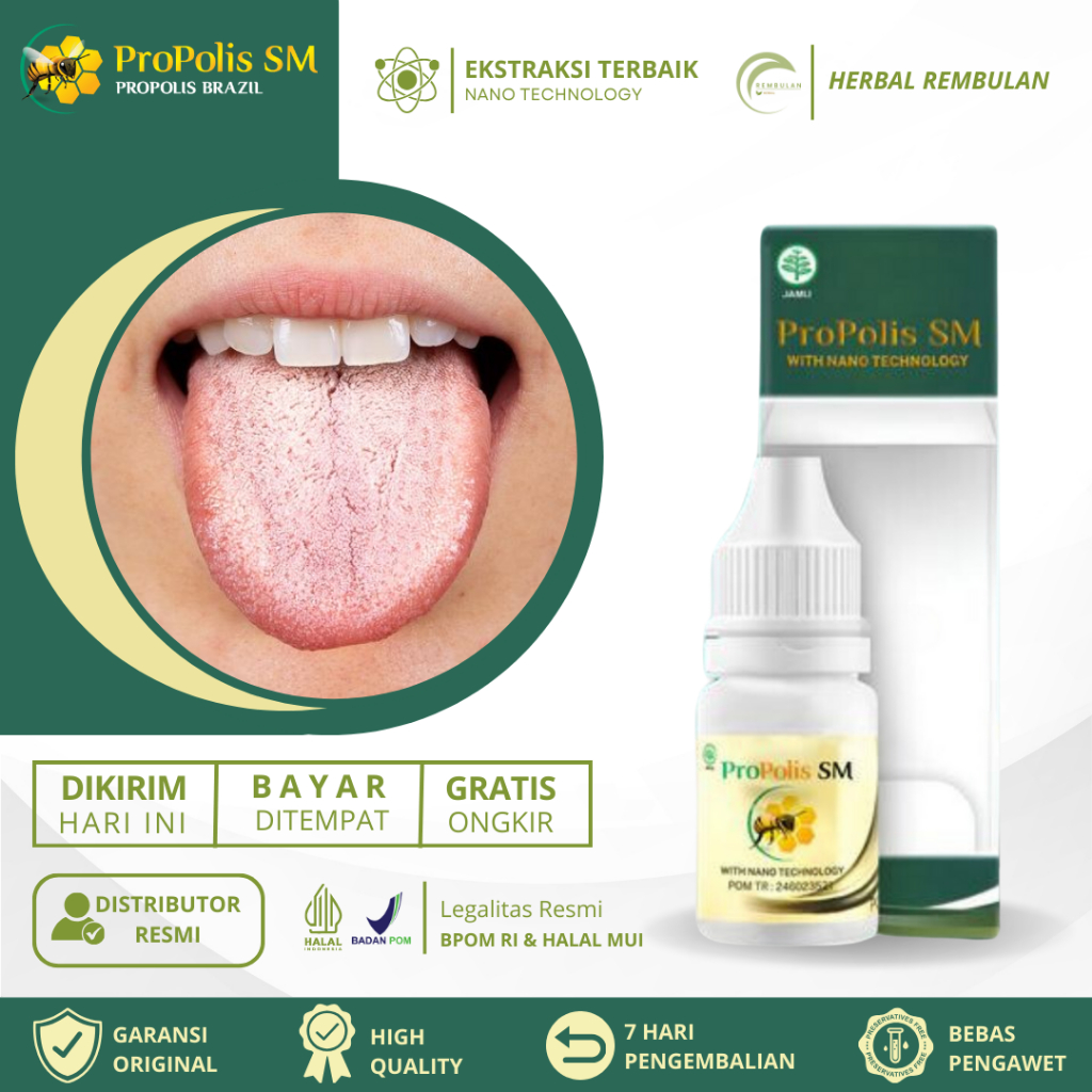 Obat Lidah Putih, Obat Lidah Berjamur, Obat Kandidiasis Lidah Putih Berjamur, Obat Oral Trush Bercak