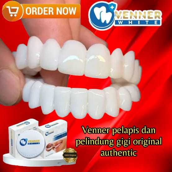 BISA COD  ||VENEER WHITE gigi palsu instant 100% ORIGINAL atas dan bawah