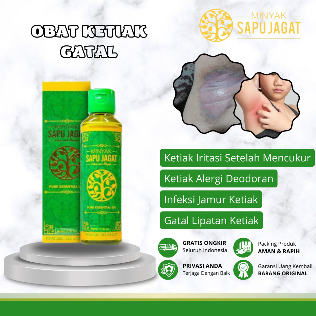 Obat Ketiak Gatal, Obat Iritasi Ketiak, Obat Infeksi Jamur Ketiak, Obat Ketiak Dermatitis, Obat Keti