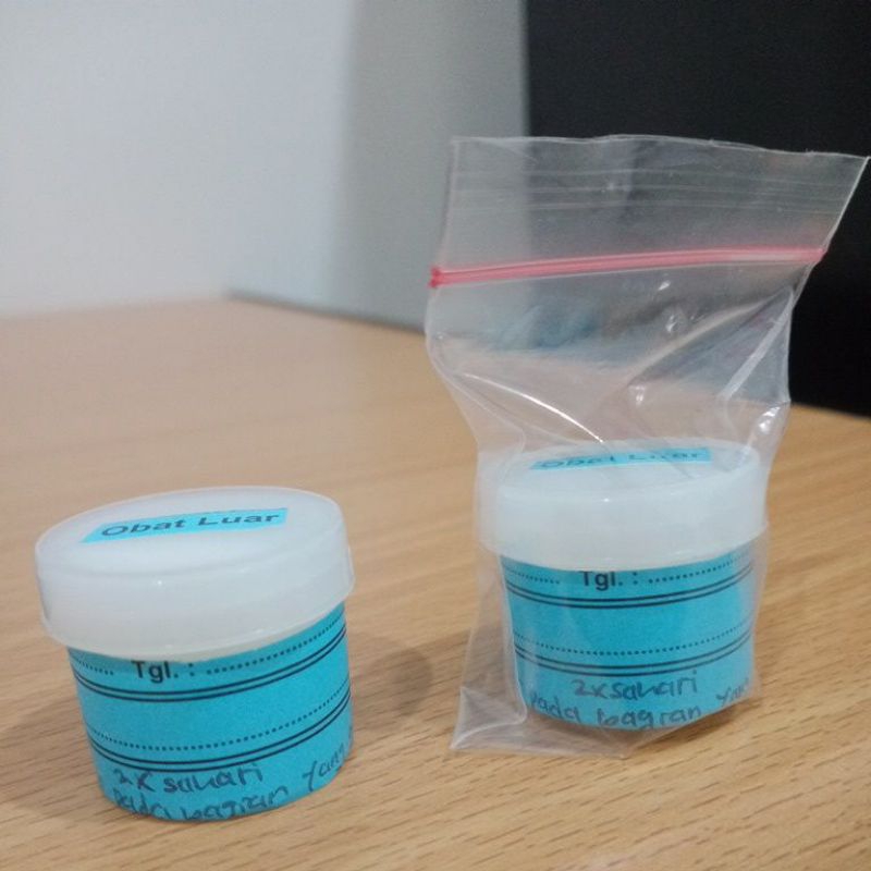 SALEP Racikan gatal-gatal paling ampuh