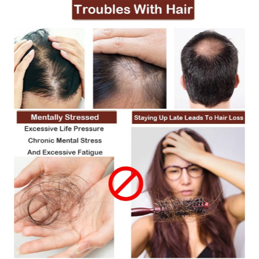 Penumbuh Rambut Botak Penumbuh Botak Dan Rontok Serum Anti Rambut Rontok Anti Hair Fall Serum Penumb