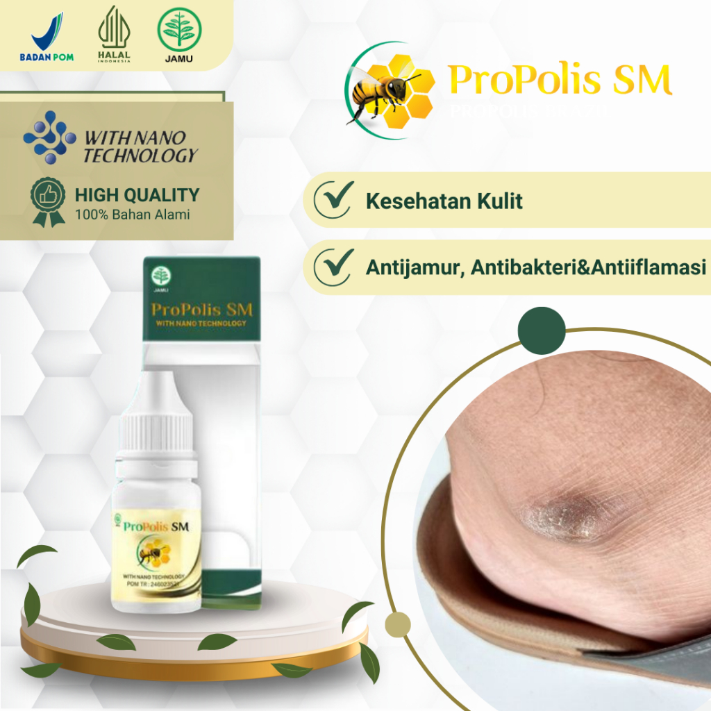 Obat Mata Kaki Hitam Kapalan, Obat Mata Kaki Kering Dan Kasar, Obat Koreng Mata Kaki, Obat Untuk Pem