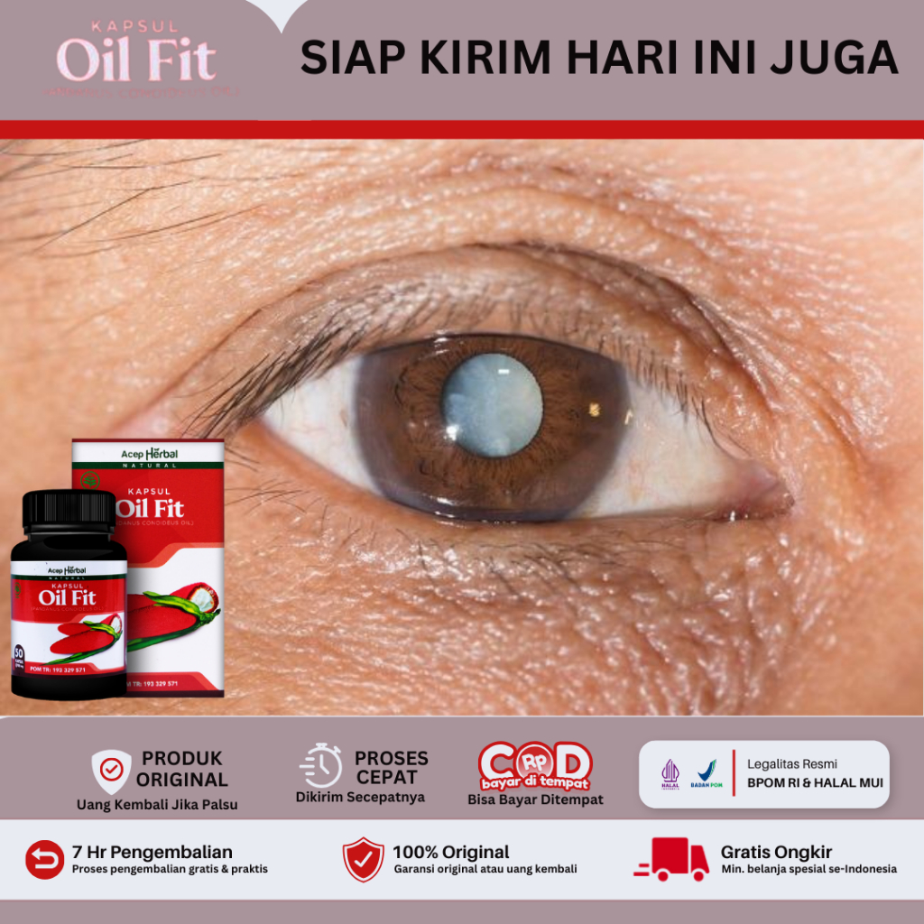 Obat Mata katarak, obat mata katarak herbal - oilFit