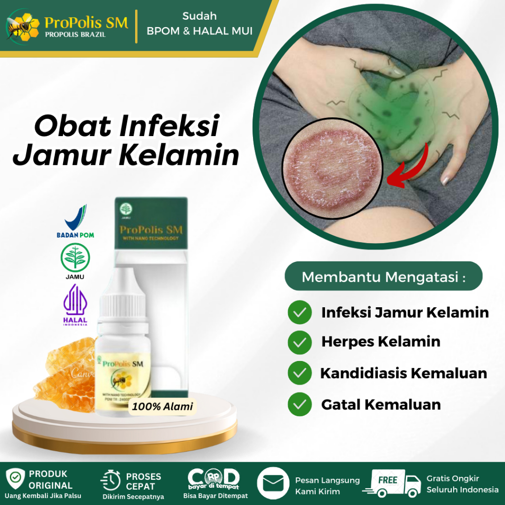 Obat Infeksi Jamur Kemaluan, Herpes Kelamin, Kandidiasis Kemaluan, Iritasi Kulit Kemaluan, Benjolan 