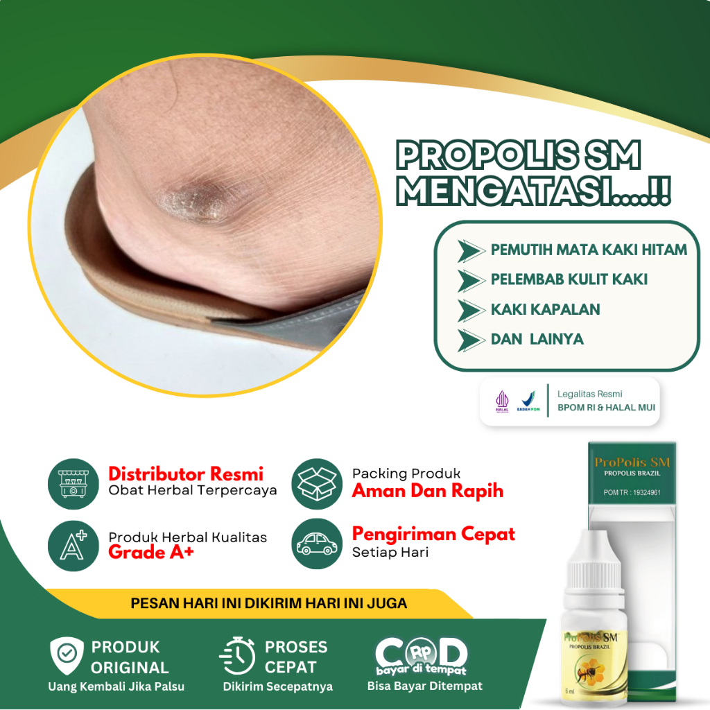 Obat Mata Kaki Hitam, Obat Pemutih Mata Kaki Hitam, Mata Kaki Hitam dan Kasar, Kering, Salep Pembers