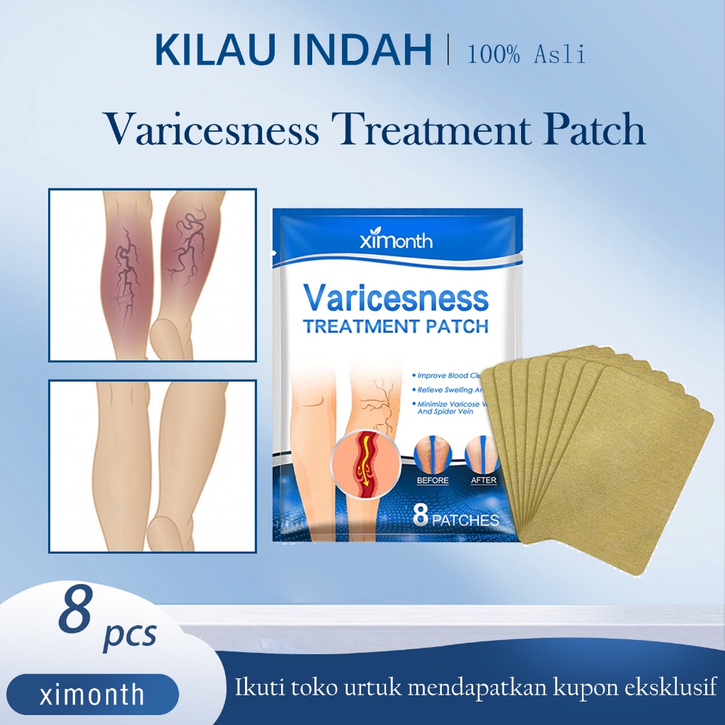ORIGINAL Varicose Veins Herbal Heling Patch 8pcs obat varises Koyo Varises Herbal Obat penghilang Va
