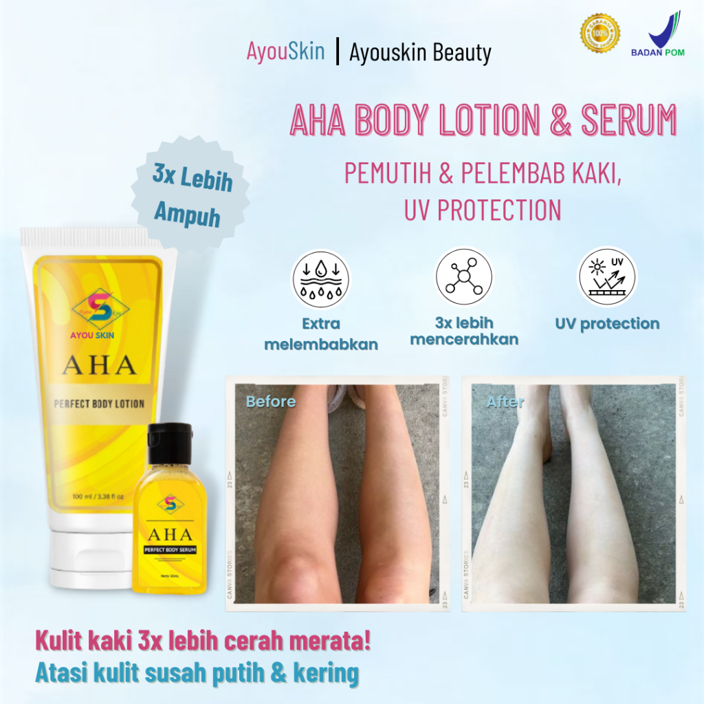 Krim Pencerah/Mencerahkan kaki, Lotion pemutih kaki belang, pemutih kaki permanen, penghilang kaki h