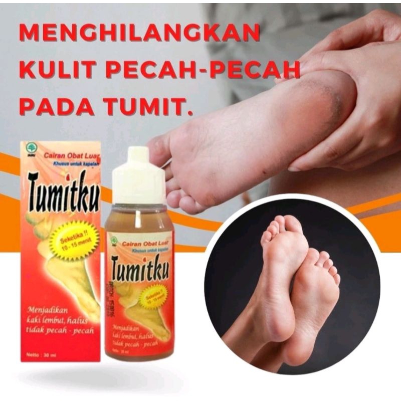 TUMITKU//Obat Tumit Kapalan//Obat tumit pecah-pecah