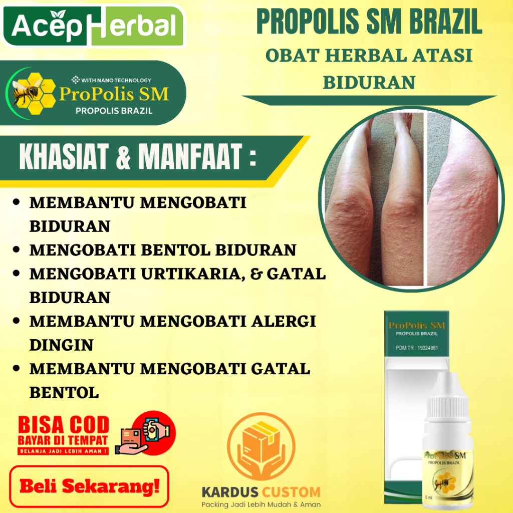 Obat Biduran - Obat Bentol Biduran, Obat Urtikaria, Obat Gatal Biduran, Obat Alergi Dingin, Obat Bid