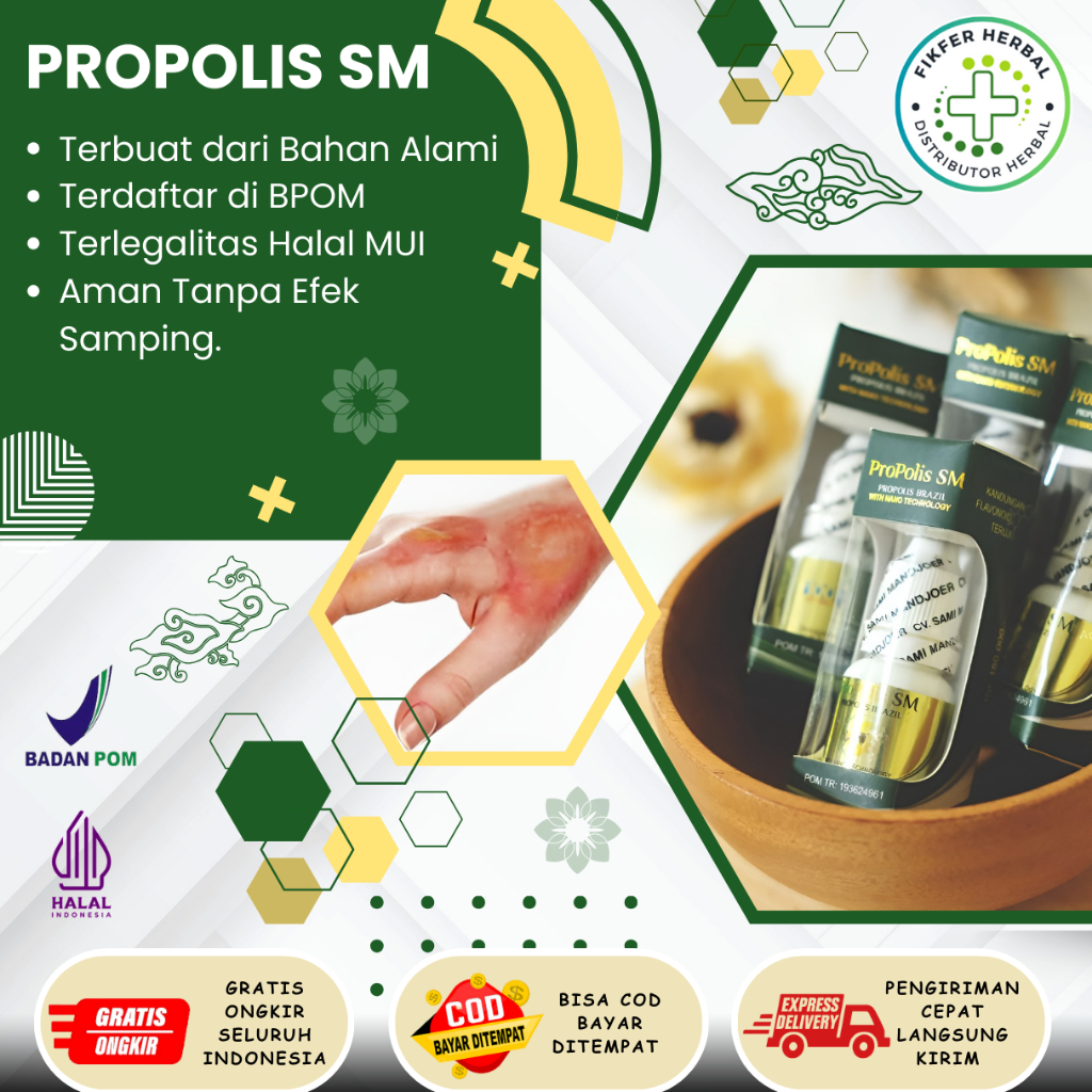 Obat Luka, Penghilang Bekas Luka, Luka Bakar, Terkena Knalpot, Obat Luka Terkena Minyak Panas, Air P