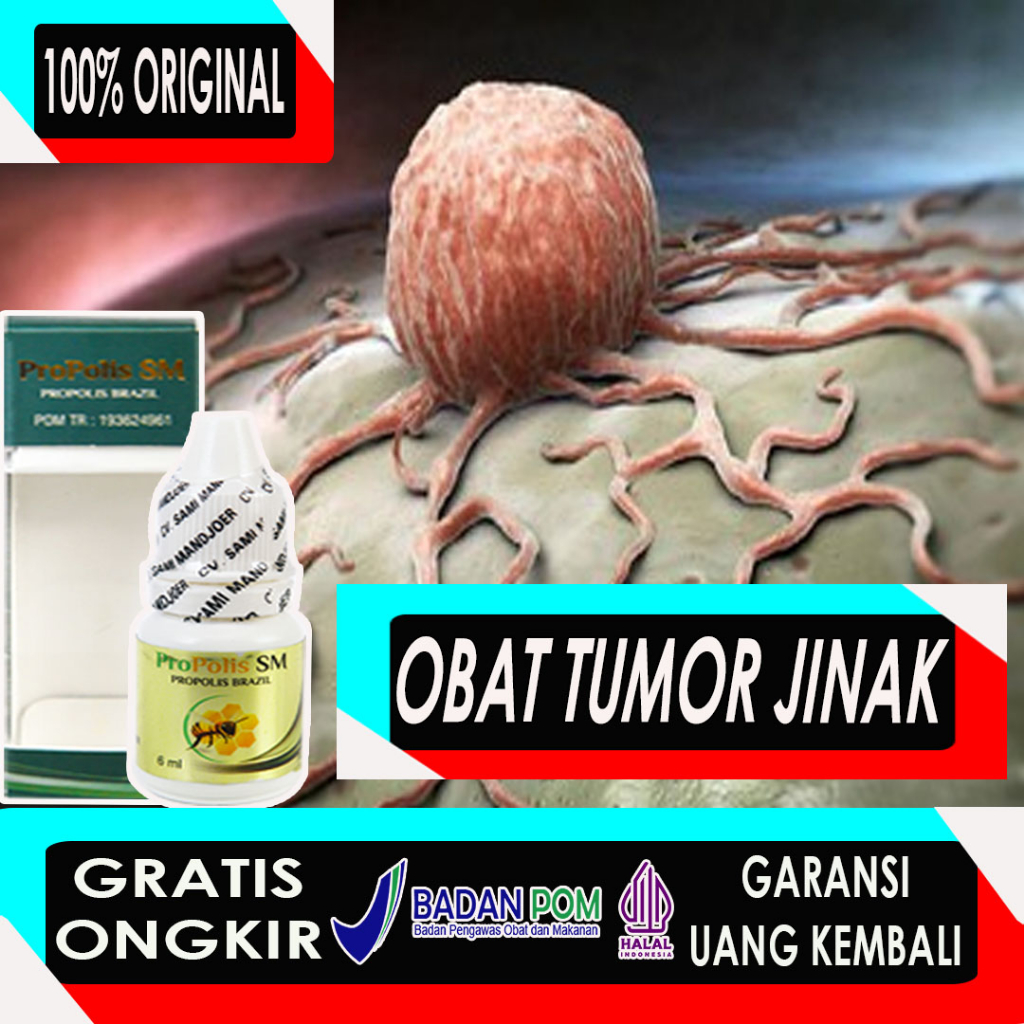 Propolis Sm - Obat Untuk Tumor Jinak Tumor Jinak Di Kepala Tumor Di Kaki Obat Tumor Neuroma