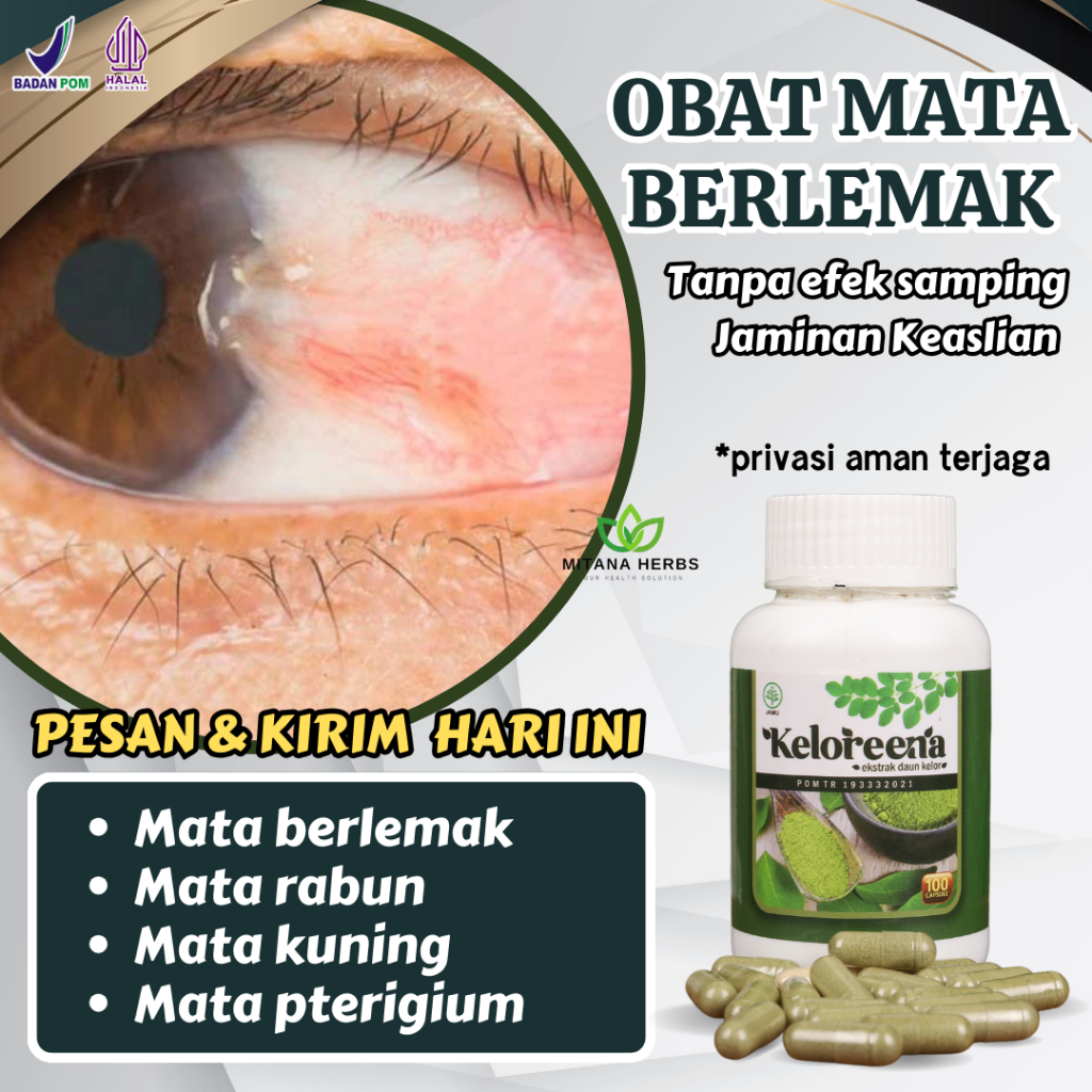 Mitana Herbal / Obat Mata Berlemak / Obat Lemak Mata / Obat Mata Minus / Obat Mata Katarak