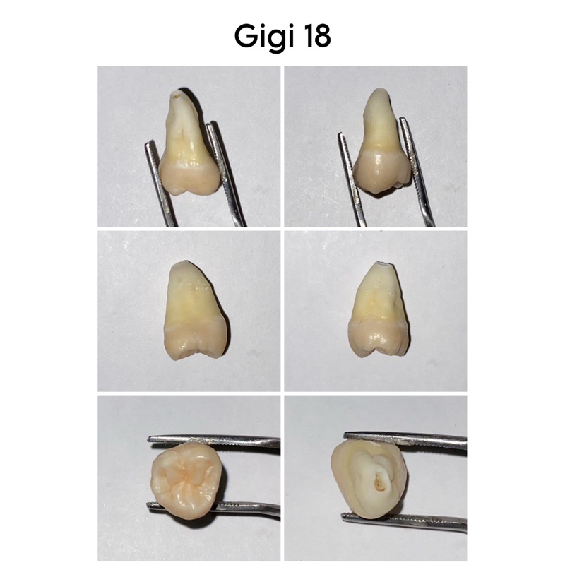 Gigi asli manusia molar premolar | gigi praktikum