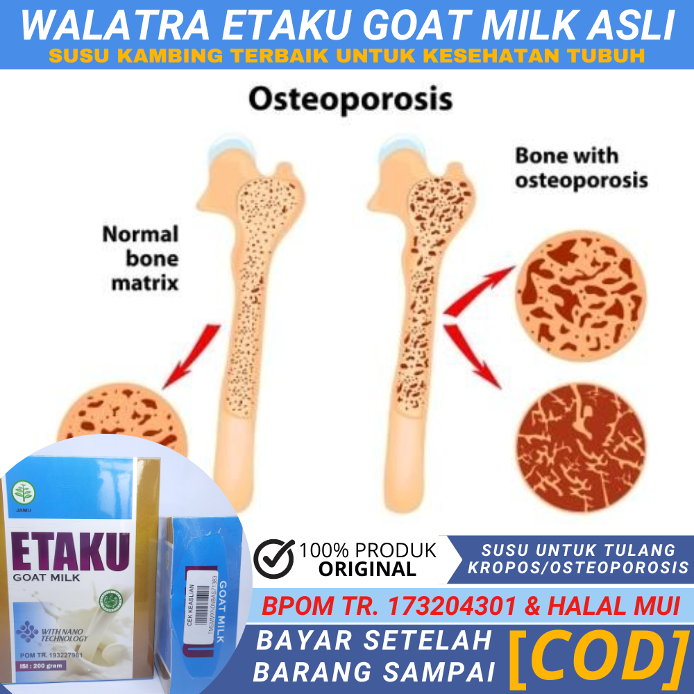 Vitamin Tulang, Tulang Keropos, Tulang Retak, Tulang Belakang, Tulang Ekor, Patah Tulang Tangan Ping