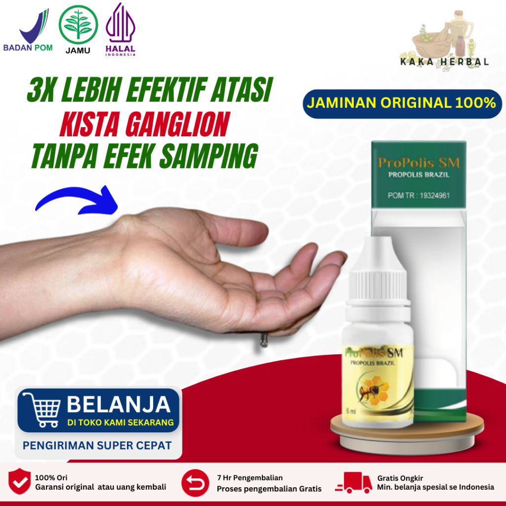 Kaka Herbal - Obat Penghancur Kista Ganglion, Obat Kista Ganglion, Obat Oles Kista Ganglion, Benjola