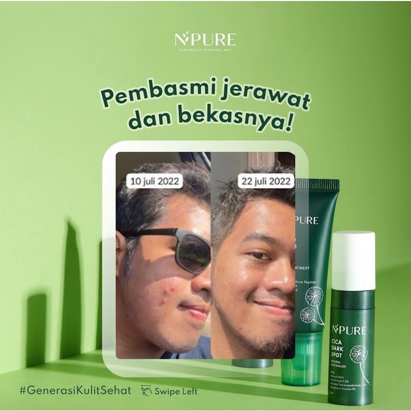 NPURE Spot Treatment acne spot dark spot N’pure npure n pure