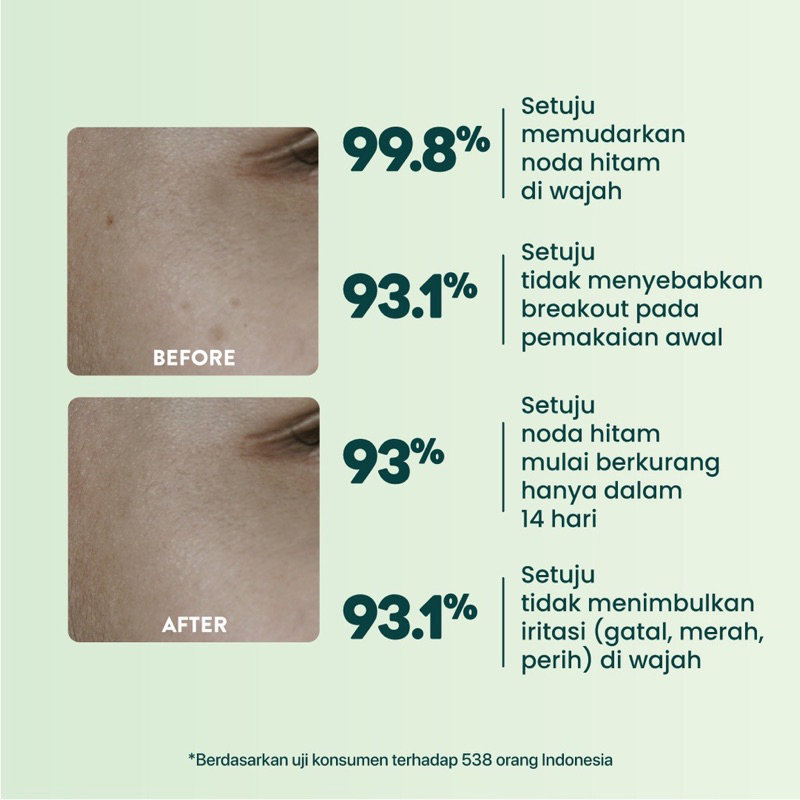 NPURE Spot Treatment acne spot dark spot N’pure npure n pure