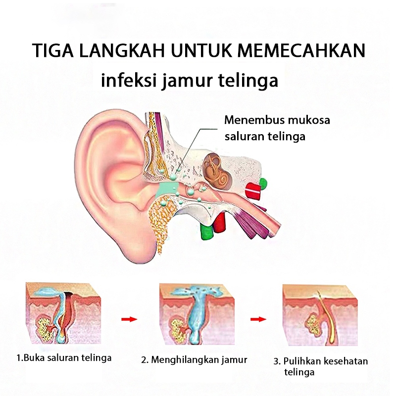 Obat tetes telinga obat telinga cairan pembersih telinga 20ml obat telinga berair telinga tuli permanen obat telinga bernanah obat telinga berair curek-berdengung