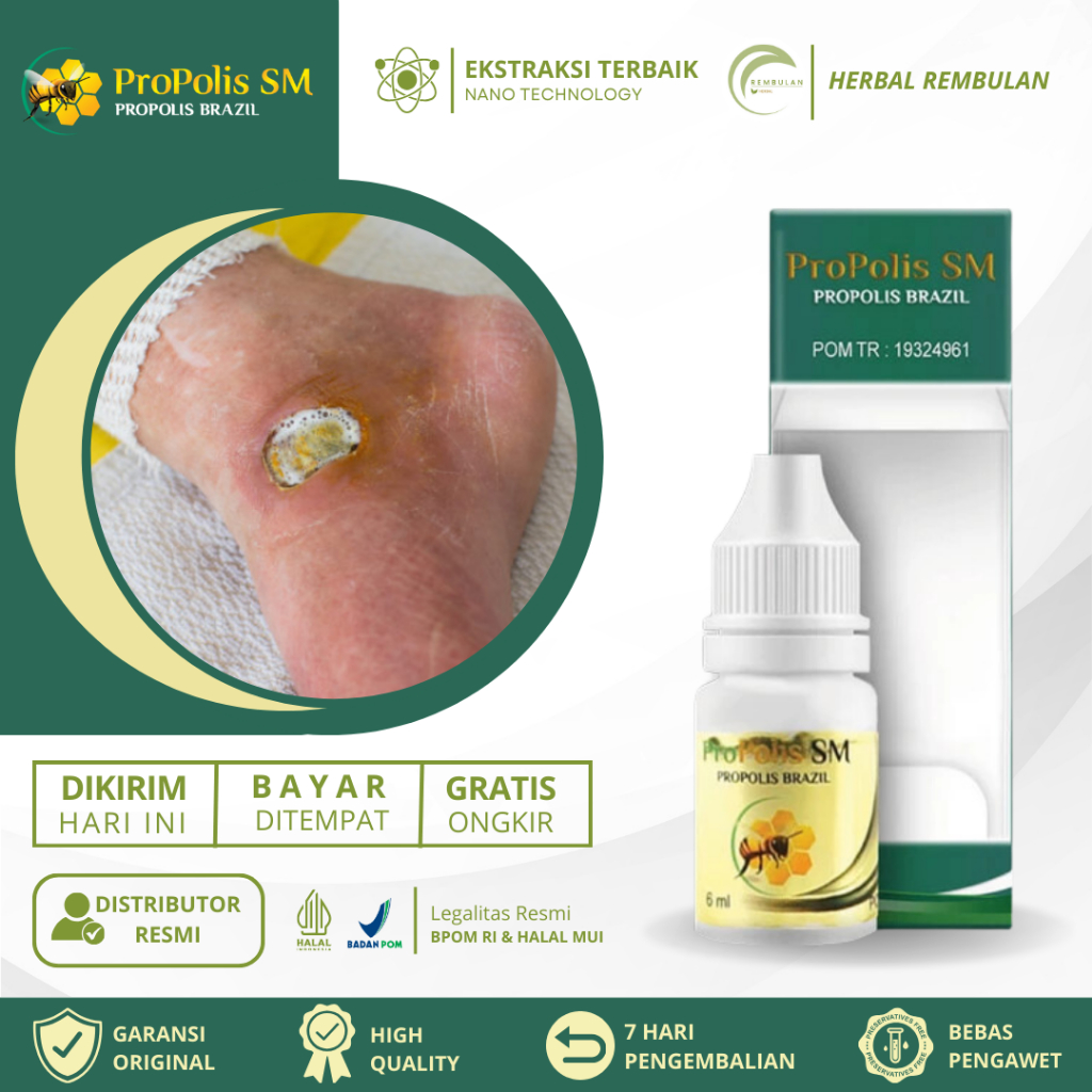 Obat Luka Diabetes, Pengering Luka Diabetes, Obat Luka Diabetes Kering Luka Diabetes Basah Luka Diab
