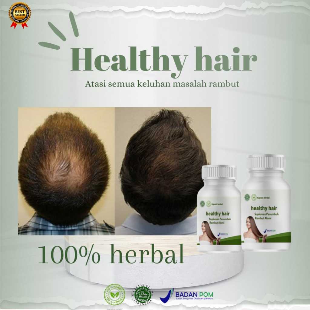 HEALTHY HAIR penumbuh rambut pria wanita botak dan rontok paling aman ampuh dan cepat BPOM obat penumbuh rambut cepat vitamin penumbuh rambut herbal alami