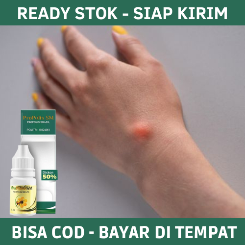 Obat Benjolan di Tangan, Obat Penghilang Benjolan di Tangan, Obat Untuk Benjolan di Tangan, Obat Ben