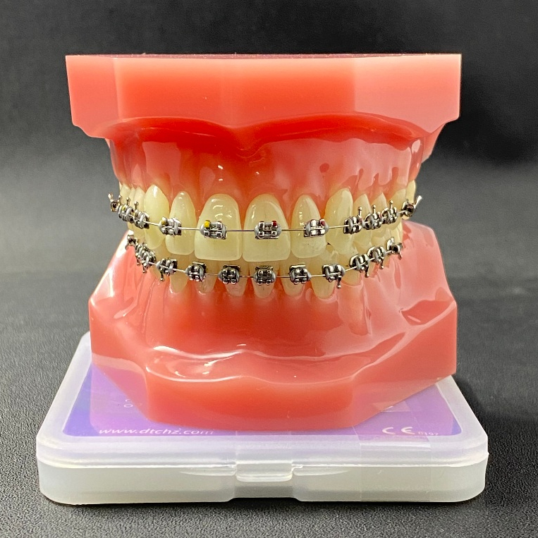 Bracket Zeal Plus DTC (KUALITAS PREMIUM) BEHEL GIGI/BRACKET BEHEL PERAWATAN GIGI/BRACKET USA