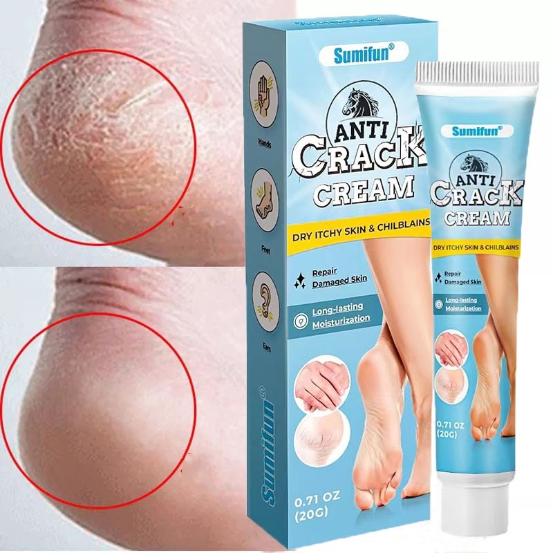 Krim kaki pecah dan kering salep kaki pecah dan kering ampuh perawatan kaki pecah dan kering 20g tum