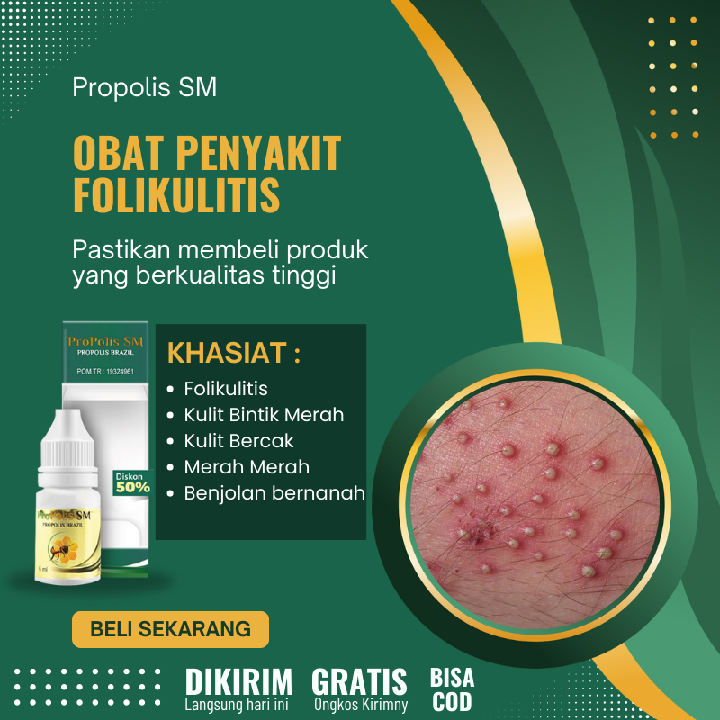 OBAT UNTUK FOLIKULITIS, KULIT BINTIK BINTIK MERAH GATAL BERKERAK MERAH, OBAT HERBAL FUTIKULITIS / JE