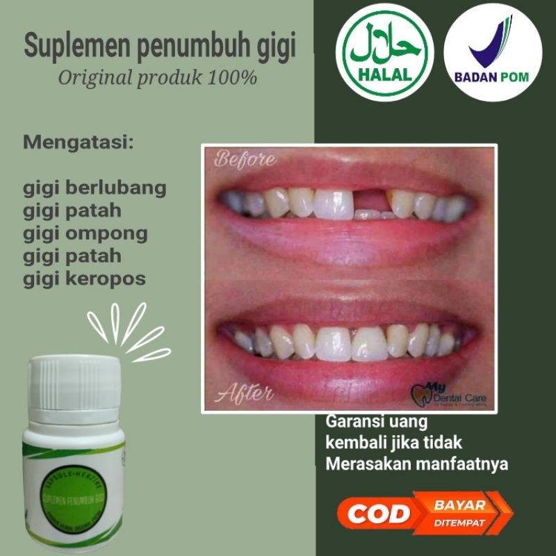 PENUMBUH GIGI ALAMI,GIGI BOLONG,PATAH,BERLUBANGAMPUH ORIGINAL 100%