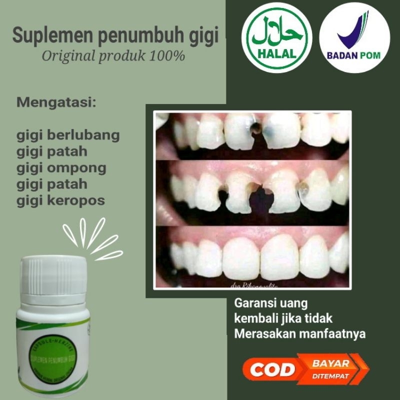 SUPLEMEN PENUMBUH GIGI BOLONG,PATAH,BERLUBANGAMPUH ORIGINAL 100%