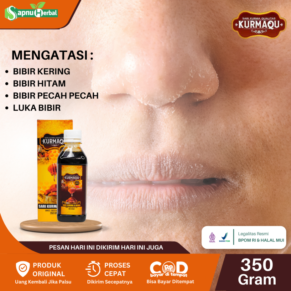 Obat Bibir Kering Gatal Hitam Bibir Kering Pecah Bibir Kering Luka Bibir Kering Mengatasi Bibir Keri